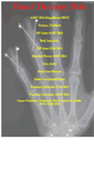 Mobile Screenshot of handtherapyhub.com